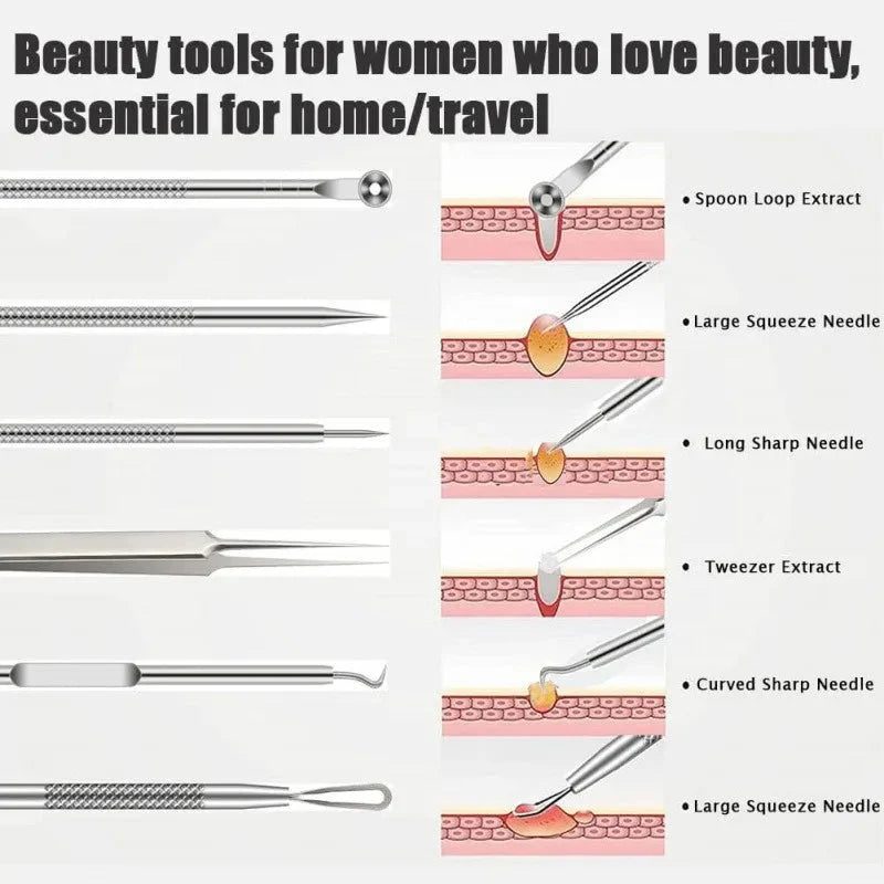 6-Piece Stainless Steel Blackhead & Pimple Removal Kit
