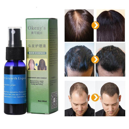 Sunburst Hair Growth Solutions: Anti-Hair Loss Spray and Beard Oil