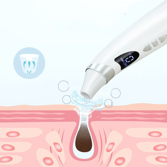 Electric Blackhead Suction Cleaner