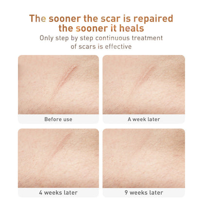 Traditional Chinese Medicine Scar Removal Cream