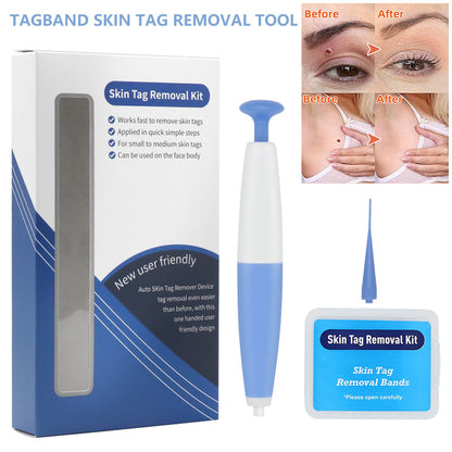 Skin Tag Removal Kit Mole Wart Remover