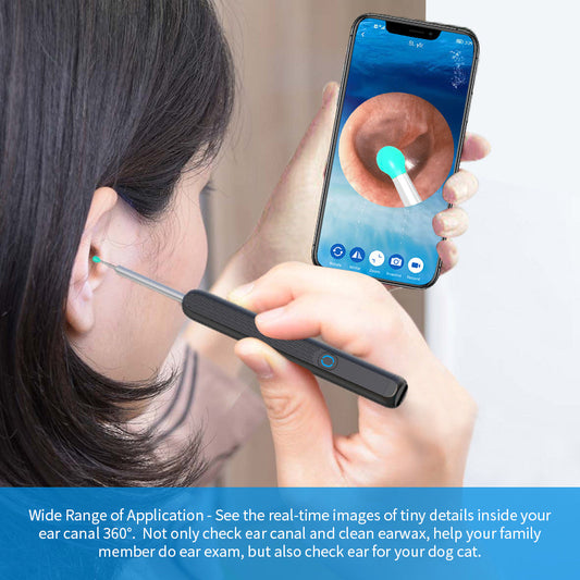 NE3 Ear Cleaner Otoscope Ear Wax Removal for iPhone