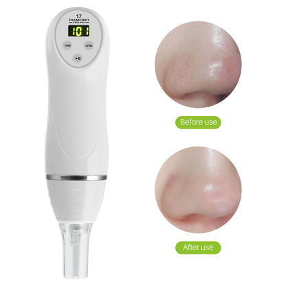 Electric Pore Suction & Acne Remover
