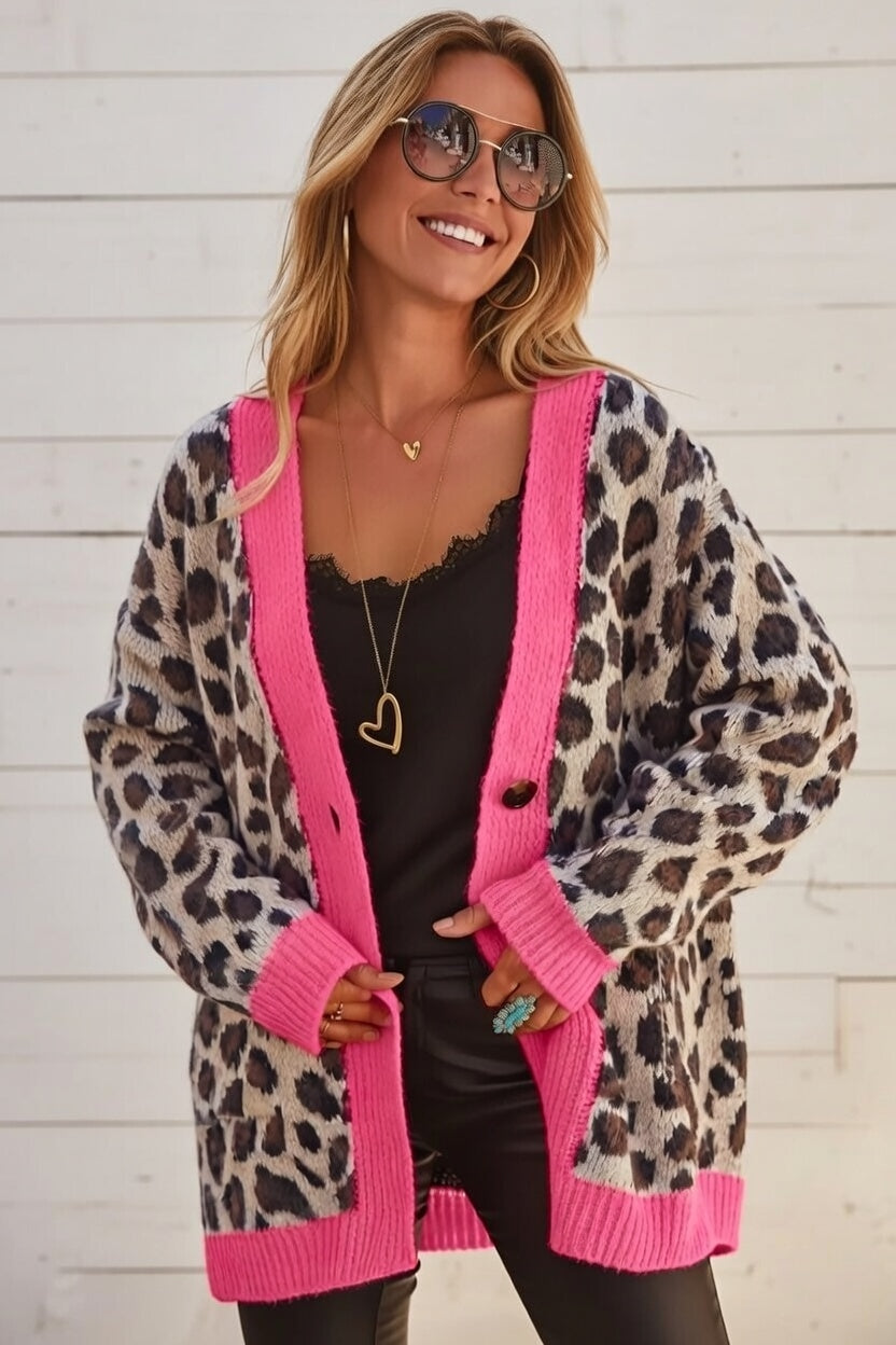 Colorblock Oversize Cardigan with Button-Down Detail