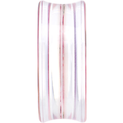 34mm Acrylic Pink Grandma's Wallpaper Flowered Saddle Plug