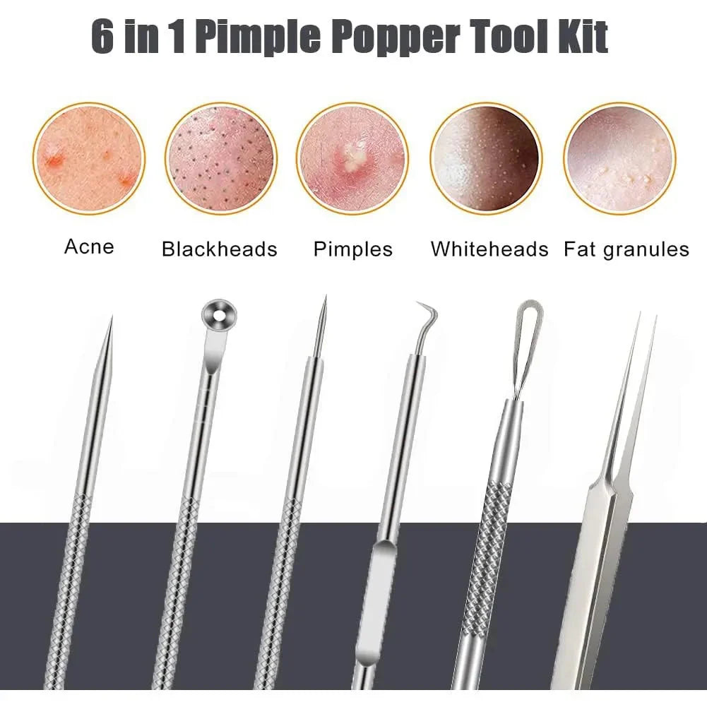 6-Piece Stainless Steel Blackhead & Pimple Removal Kit