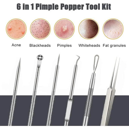 6-Piece Stainless Steel Blackhead & Pimple Removal Kit