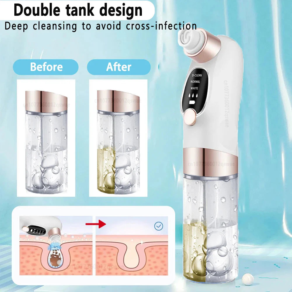 USB-Rechargeable Visual Blackhead Vacuum