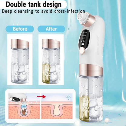 USB-Rechargeable Visual Blackhead Vacuum