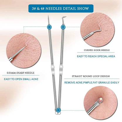 Stainless Steel Blackhead & Whitehead Extractor Kit