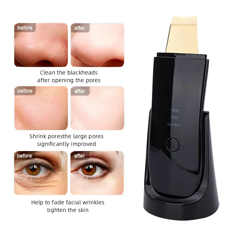 Ultrasonic Skin Scrubber Facial Cleaner