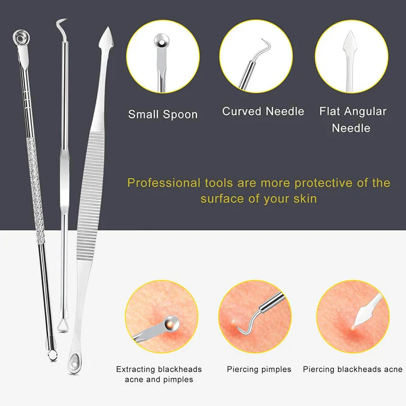 Professional 10‑Piece Blackhead & Pimple Extractor Kit