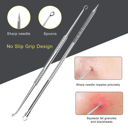 Professional 10‑Piece Blackhead & Pimple Extractor Kit