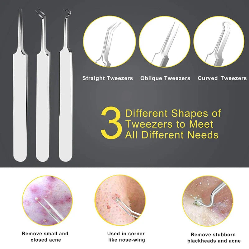Professional 10‑Piece Blackhead & Pimple Extractor Kit