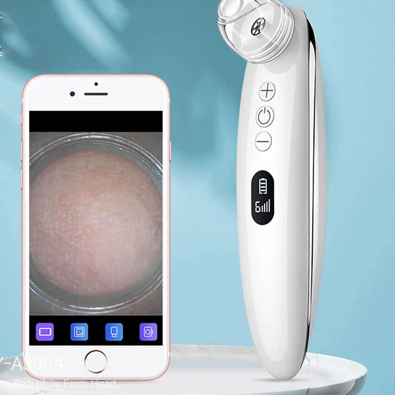 Visual Blackhead Vacuum Kit – HD Camera Deep Clean, 6-Level Suction
