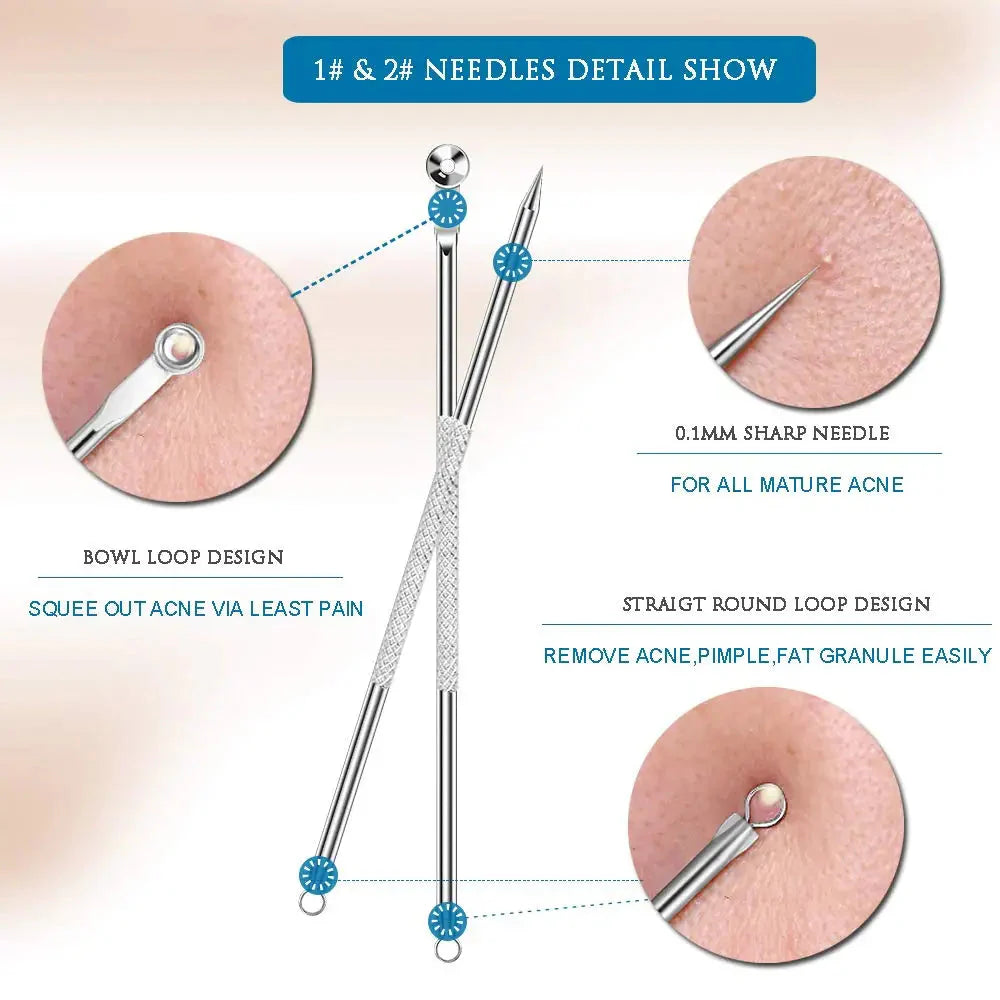 Stainless Steel Blackhead & Whitehead Extractor Kit
