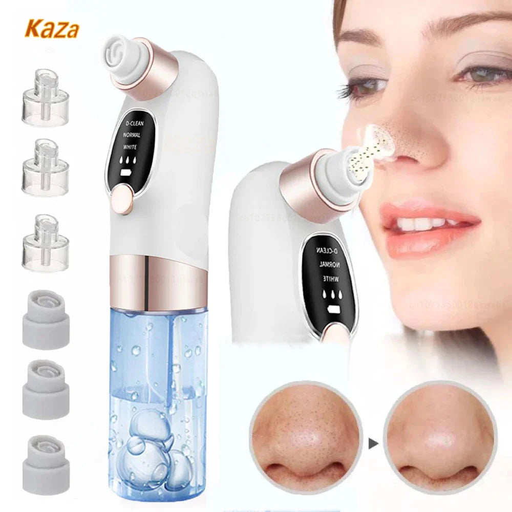 USB-Rechargeable Visual Blackhead Vacuum