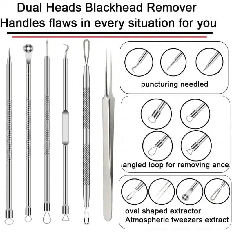 6-Piece Stainless Steel Blackhead & Pimple Removal Kit