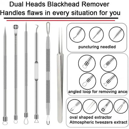 6-Piece Stainless Steel Blackhead & Pimple Removal Kit