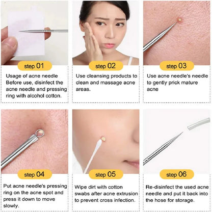 Stainless Steel Blackhead & Whitehead Extractor Kit