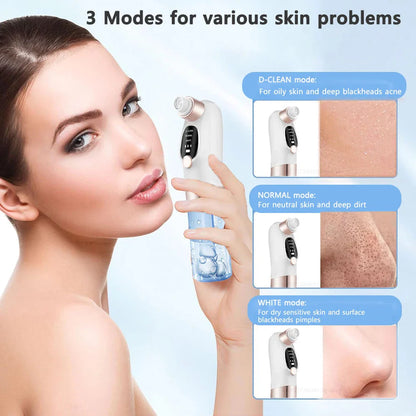 USB-Rechargeable Visual Blackhead Vacuum