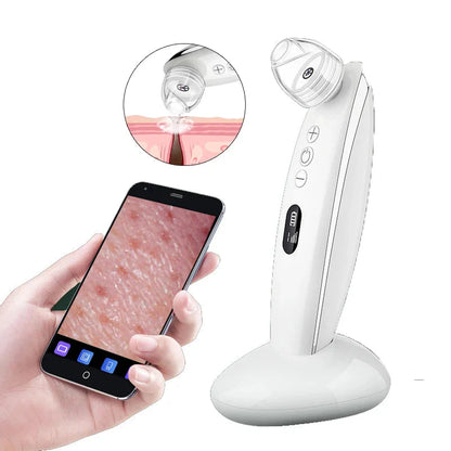 Visual Blackhead Vacuum Kit – HD Camera Deep Clean, 6-Level Suction