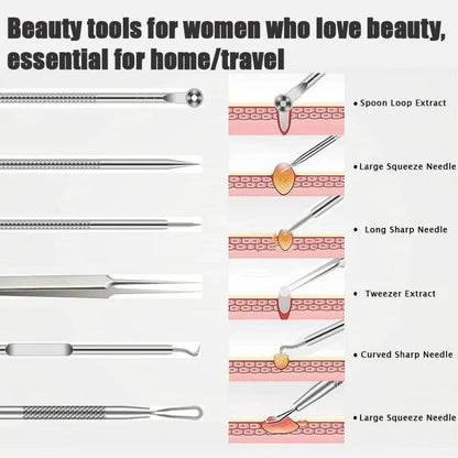 6-Piece Stainless Steel Blackhead & Pimple Removal Kit