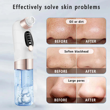 USB-Rechargeable Visual Blackhead Vacuum