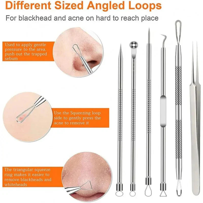 6-Piece Stainless Steel Blackhead & Pimple Removal Kit