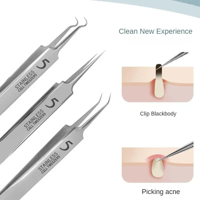 11‑Piece Ultra‑Fine Acne & Blackhead Tweezers Set
