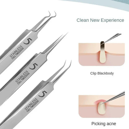 11‑Piece Ultra‑Fine Acne & Blackhead Tweezers Set