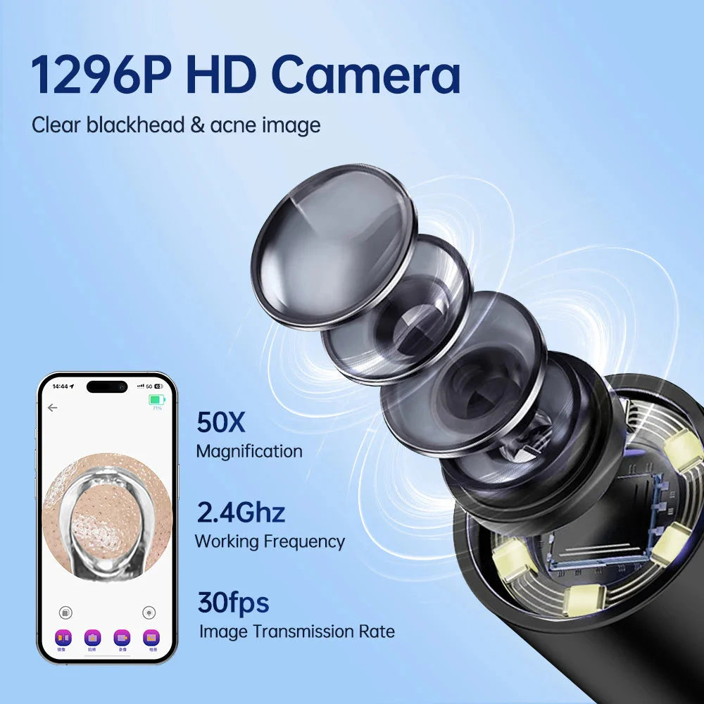 Visual Blackhead Remover with Camera