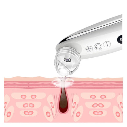 Visual Blackhead Vacuum Kit – HD Camera Deep Clean, 6-Level Suction