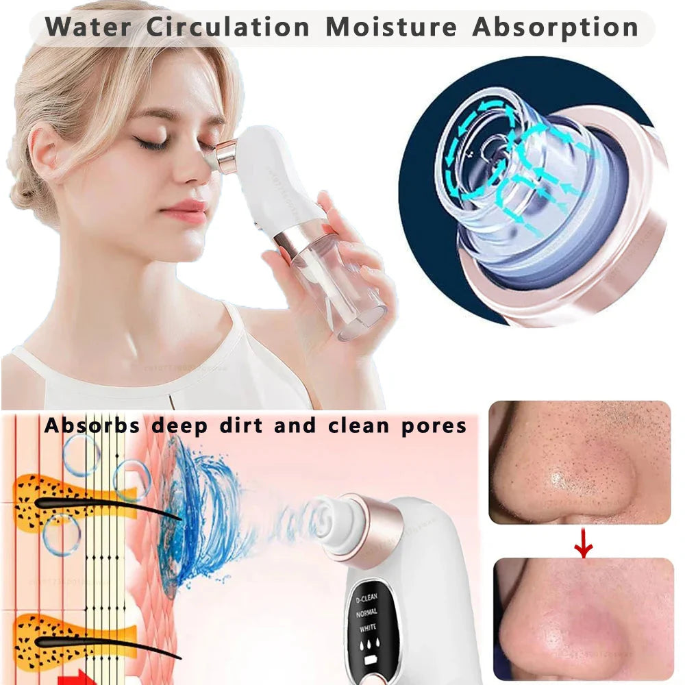 USB-Rechargeable Visual Blackhead Vacuum