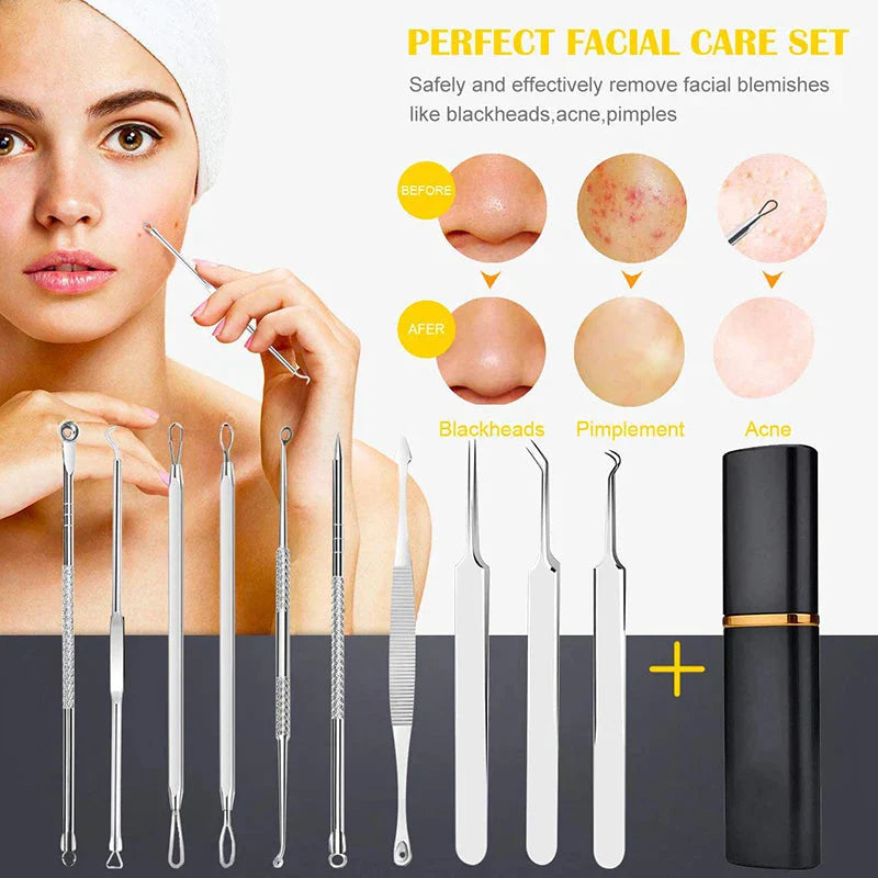 Professional 10‑Piece Blackhead & Pimple Extractor Kit