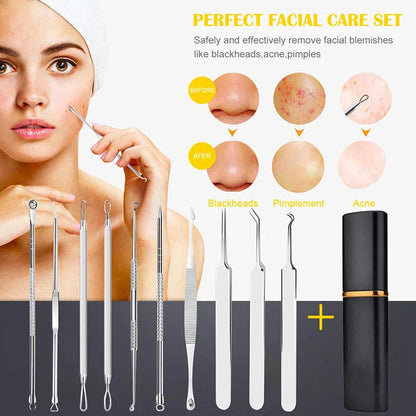 Professional 10‑Piece Blackhead & Pimple Extractor Kit