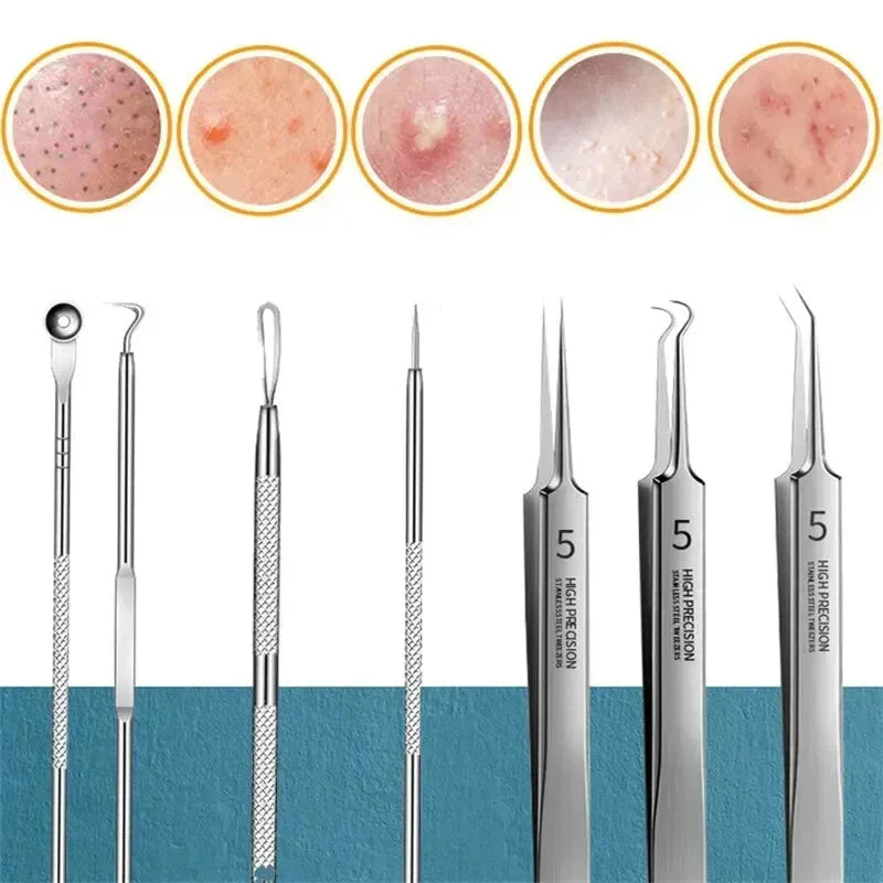 11‑Piece Ultra‑Fine Acne & Blackhead Tweezers Set