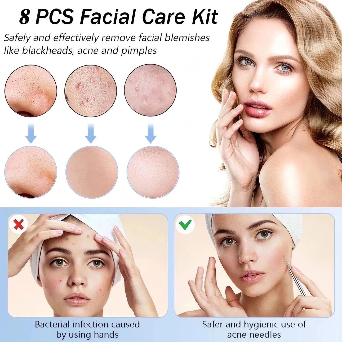 Stainless Steel Blackhead & Blemish Removal Kit