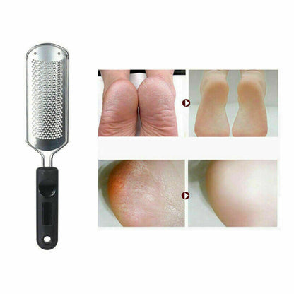 2-in-1 Foot Callus Remover and Scraper