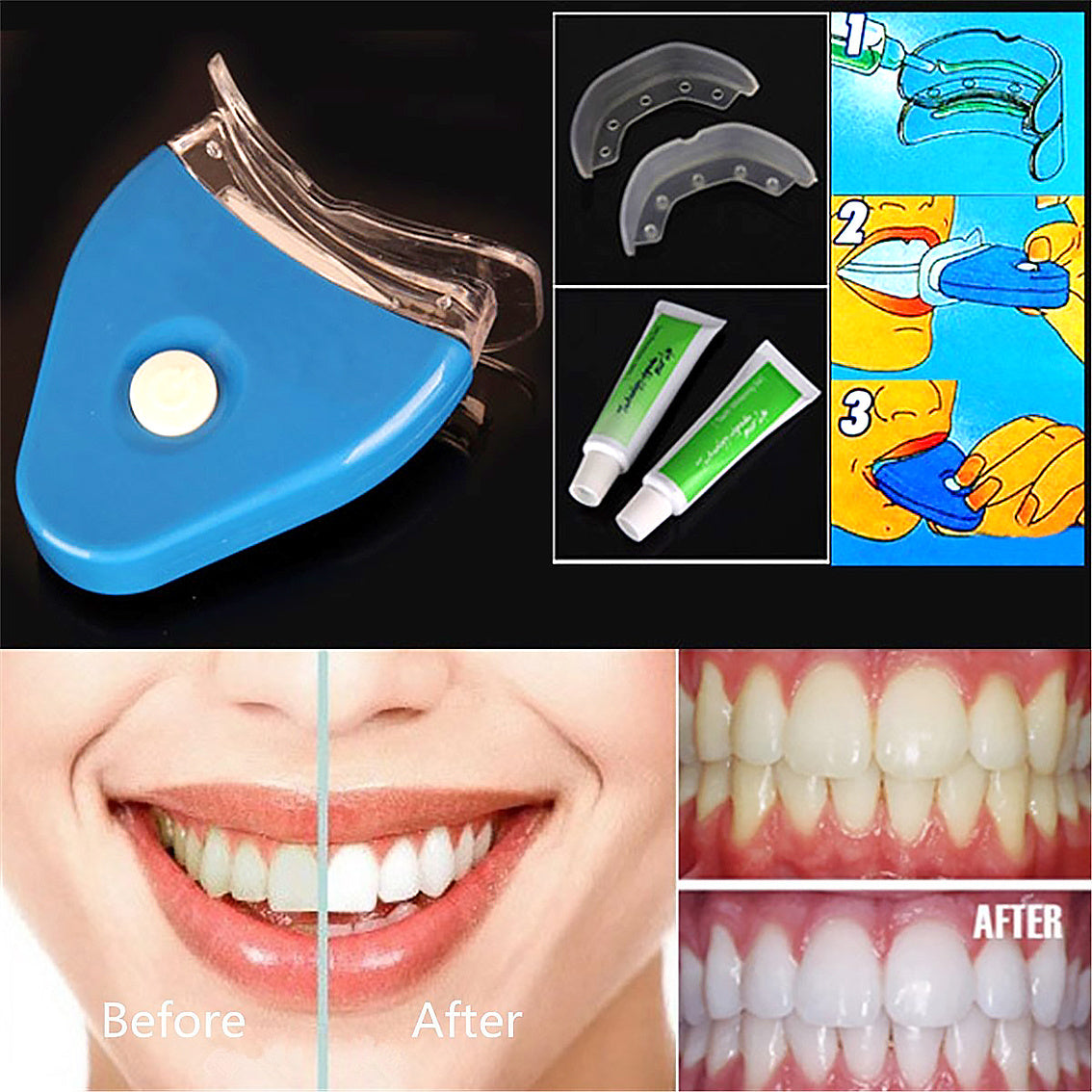 Teeth Whitening Gel LED Dental Bleaching