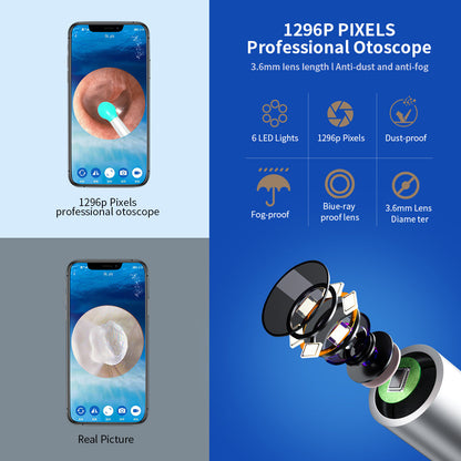 NE3 Ear Cleaner Otoscope Ear Wax Removal for iPhone